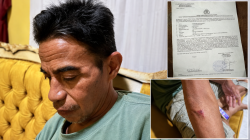 Sudah Sebulan Lebih, Keluarga Dudung Pertanyakan Perkembangan Laporan Dugaan Penganiayaan