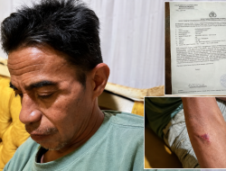 Sudah Sebulan Lebih, Keluarga Dudung Pertanyakan Perkembangan Laporan Dugaan Penganiayaan
